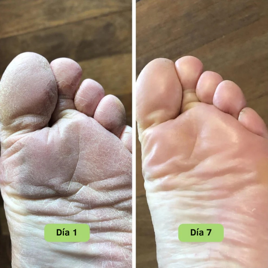 FreshSkin™ – Jabón en barra con efecto antifúngico