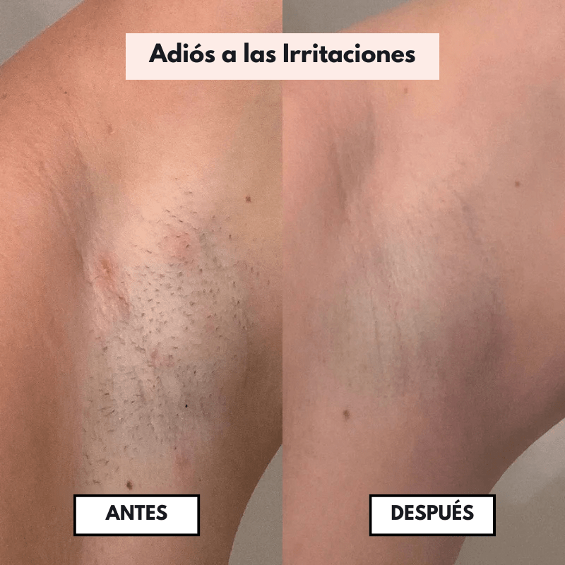 PureSkin™ – Afeitadora eléctrica para mujer - Dexvon