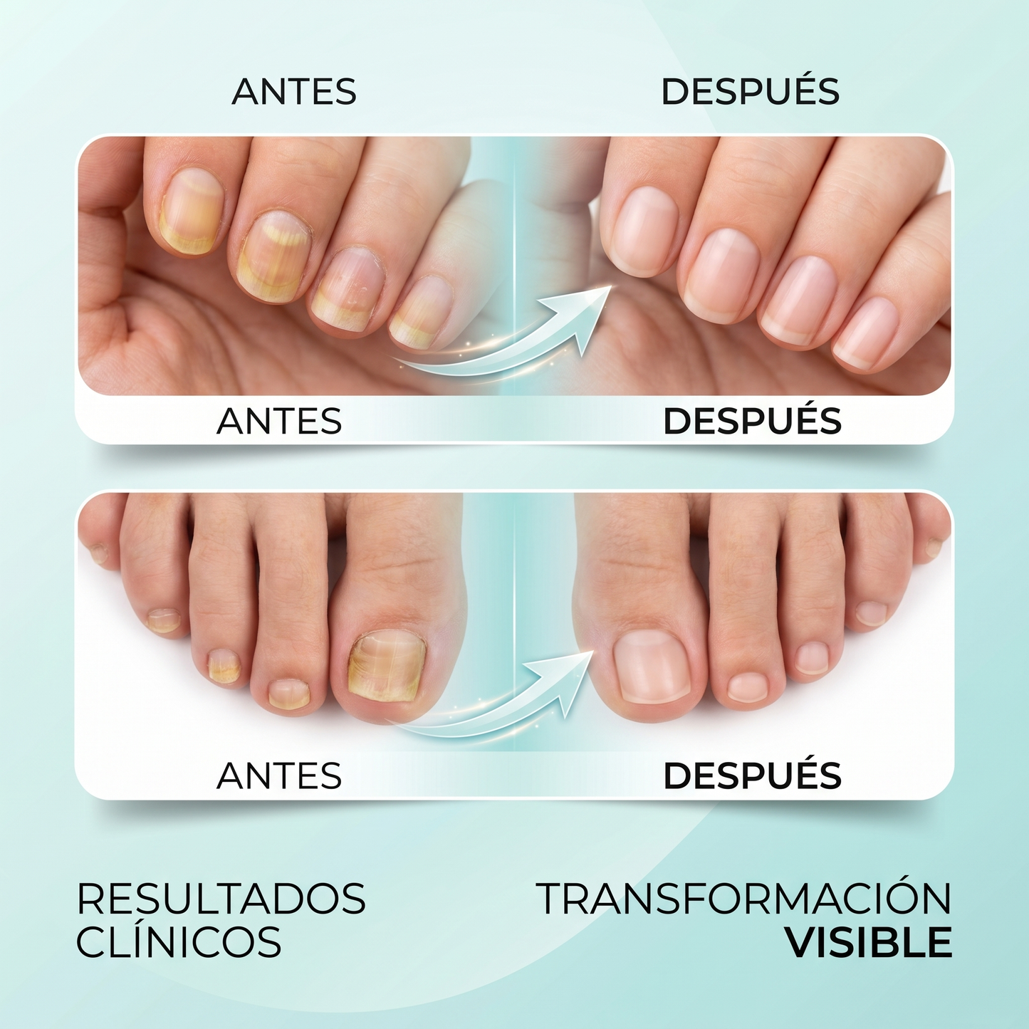 MycoCare™ – Dispositivo anti-hongos para uñas