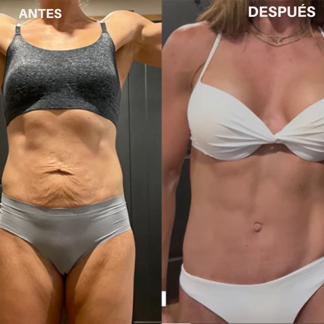 Luminexia™ – Cinturón de terapia con luz roja