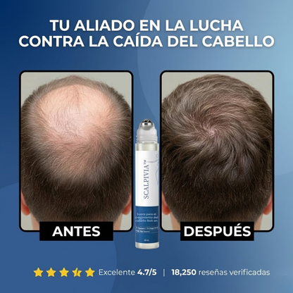 SCALPIVIA™ - Renovador capilar bioactivo en roll-on