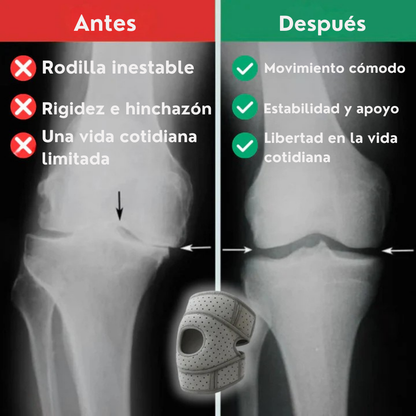 FlexiRelief™ – Rodillera de soporte total