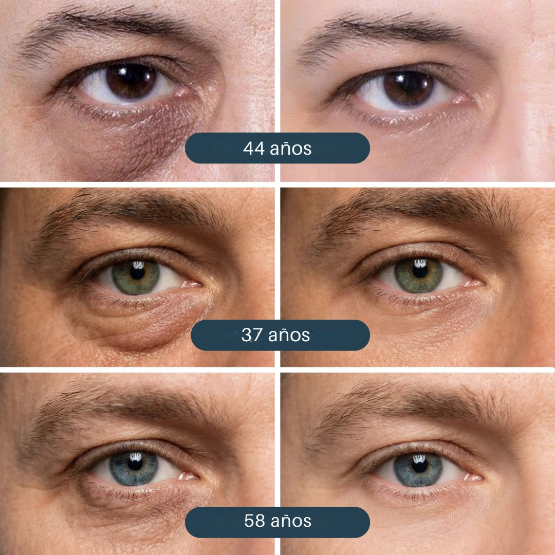 VIVOLUX™ - Parche iluminador para ojos