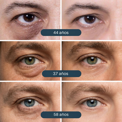 VIVOLUX™ - Parche iluminador para ojos