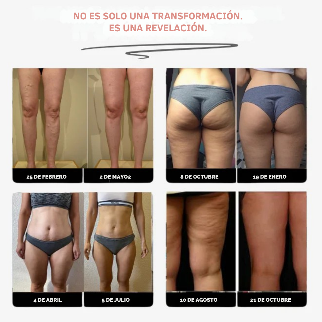 SculptaForm™ – Leggings 3D Moldeadores