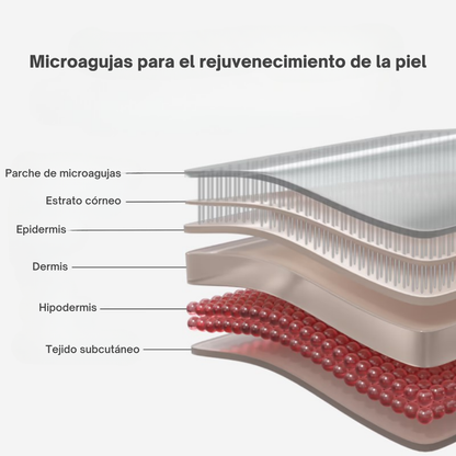 LumiEyes™ – Parches Microneedle Antiojeras