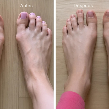 AlignaToe™ – Alivio del juanete y corrección suave