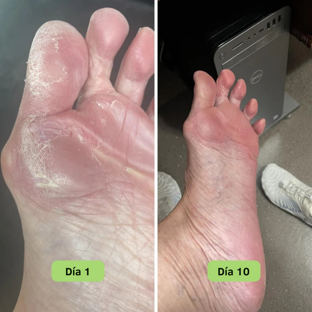 FreshSkin™ – Jabón en barra con efecto antifúngico