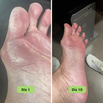FreshSkin™ – Jabón en barra con efecto antifúngico
