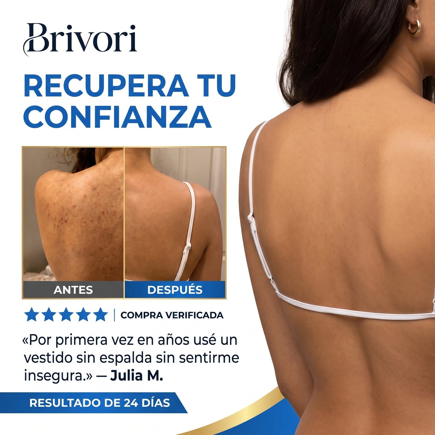 Brivori™ - Barra Limpiadora para Acné Corporal