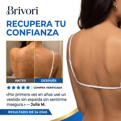 Brivori™ - Barra Limpiadora para Acné Corporal