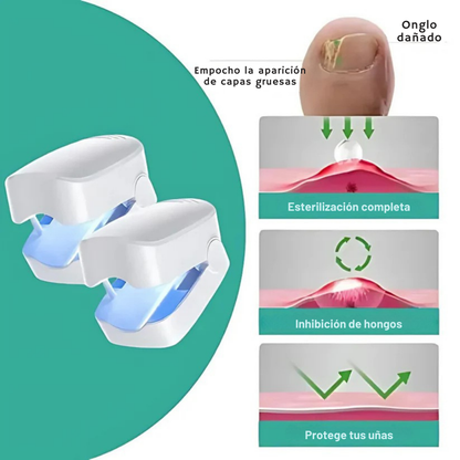 MycoCare™ – Dispositivo anti-hongos para uñas