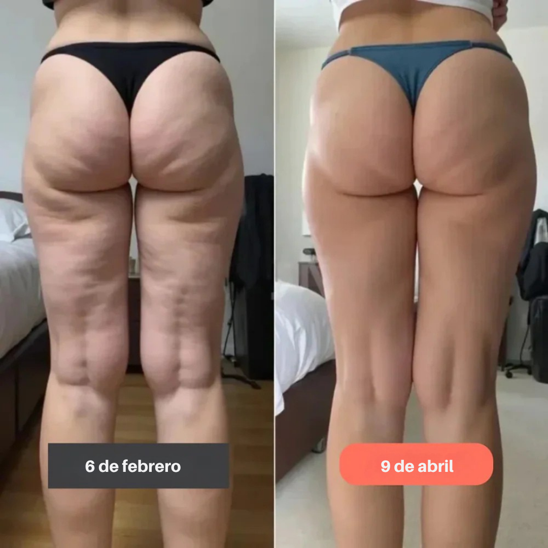 SculptaForm™ – Leggings 3D Moldeadores