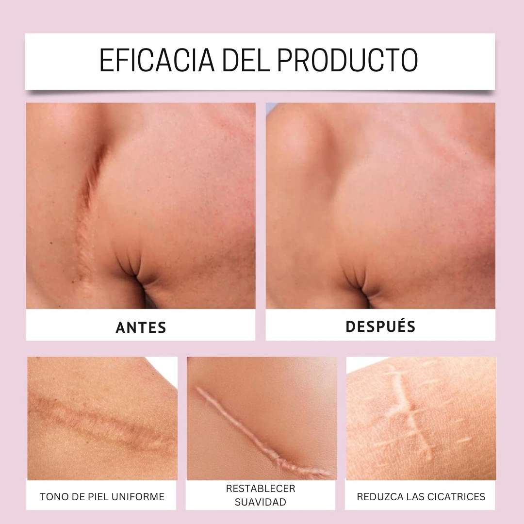 FlexiGlow™ – Hojas de Colágeno para Cicatrices y Arrugas