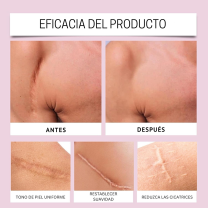 FlexiGlow™ – Hojas de Colágeno para Cicatrices y Arrugas