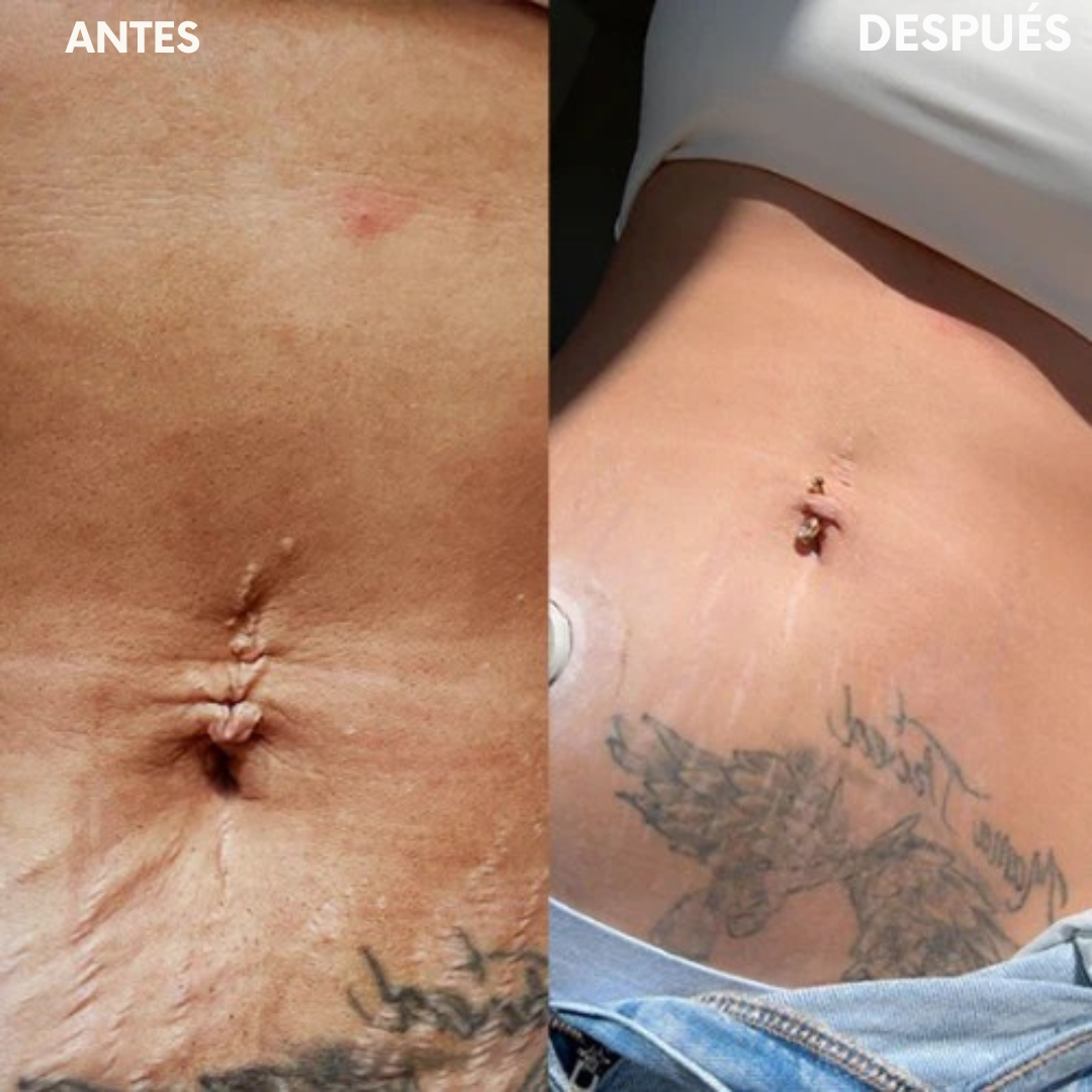 Luminexia™ – Cinturón de terapia con luz roja