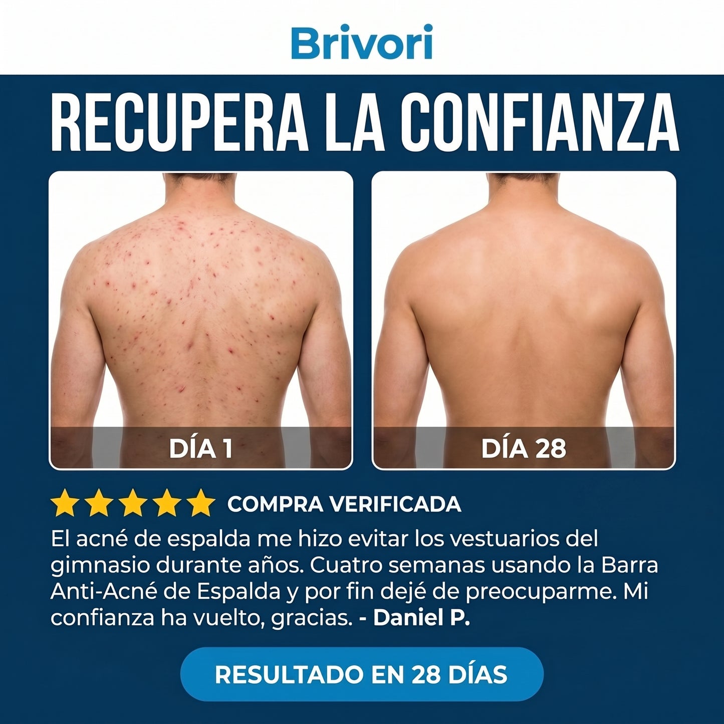 Brivori™ - Barra Limpiadora para Acné Corporal
