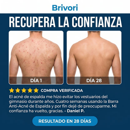 Brivori™ - Barra Limpiadora para Acné Corporal