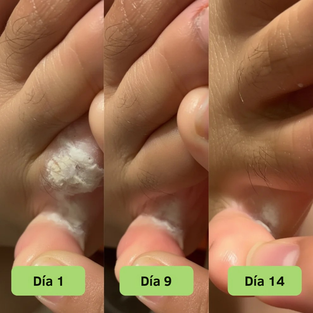 FreshSkin™ – Jabón en barra con efecto antifúngico