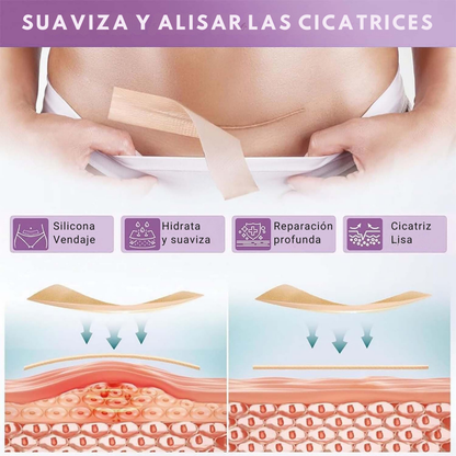 FlexiGlow™ – Hojas de Colágeno para Cicatrices y Arrugas