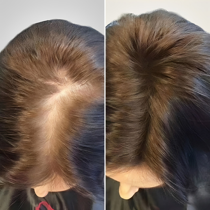 TRICOVERA™ - Ritual anticaída dermoactivo