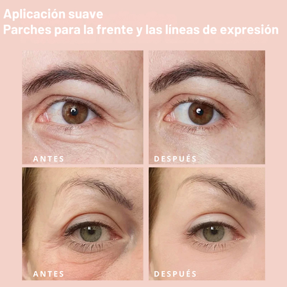 LumiEyes™ – Parches Microneedle Antiojeras
