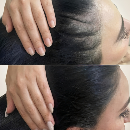 TRICOVERA™ - Ritual anticaída dermoactivo