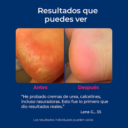 VelaSkin™ - Lima eléctrica para pies