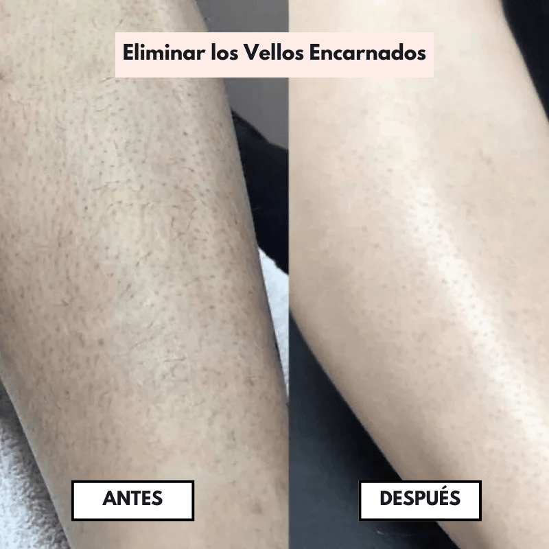 PureSkin™ – Afeitadora eléctrica para mujer - Dexvon