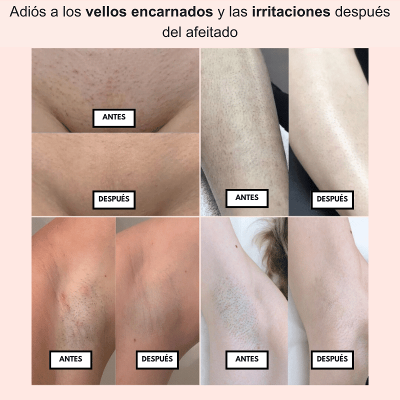 PureSkin™ – Afeitadora eléctrica para mujer - Dexvon