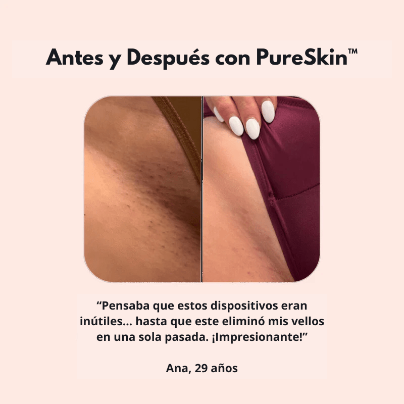 PureSkin™ – Afeitadora eléctrica para mujer - Dexvon