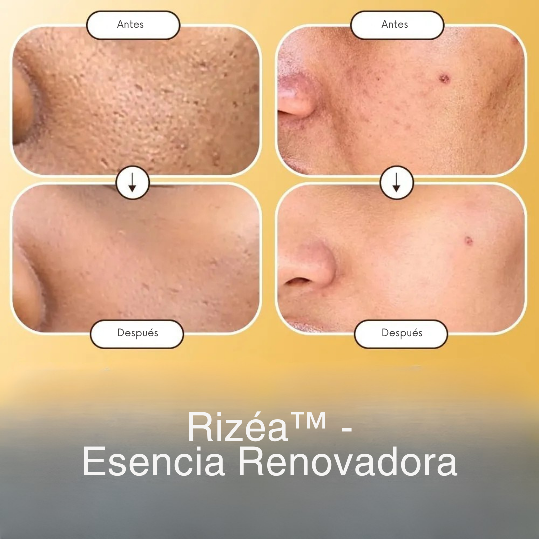 Rizéa™ - Esencia Renovadora
